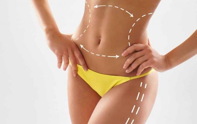 How Does SculpSure Body Contouring Work?